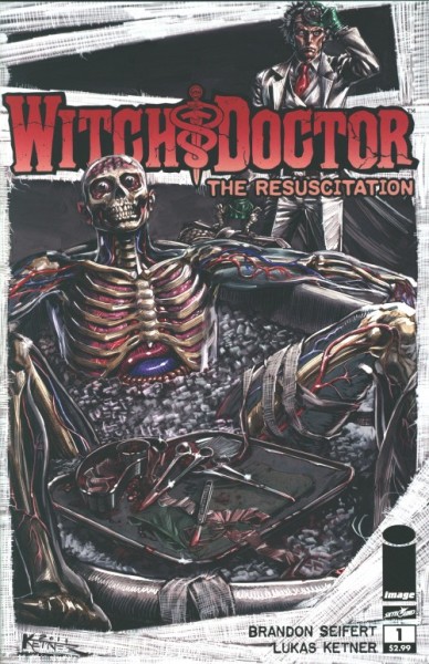 Witch Doctor: The Resuscitation (2011) 1